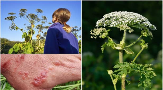 Warnings have been issued over the giant hogweed plant (Photos: Shutterstock)