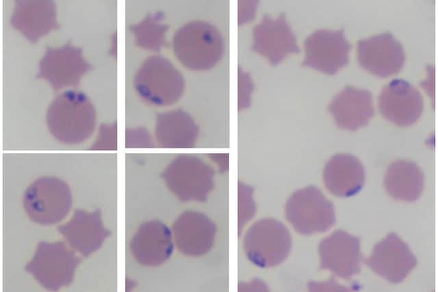 Blood smear of bovine blood depicting parasitized RBCs with intracellular inclusions of Babesia spp. (Pic: AFBI)